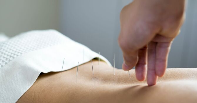 Digestion and Weight Loss Acupuncture